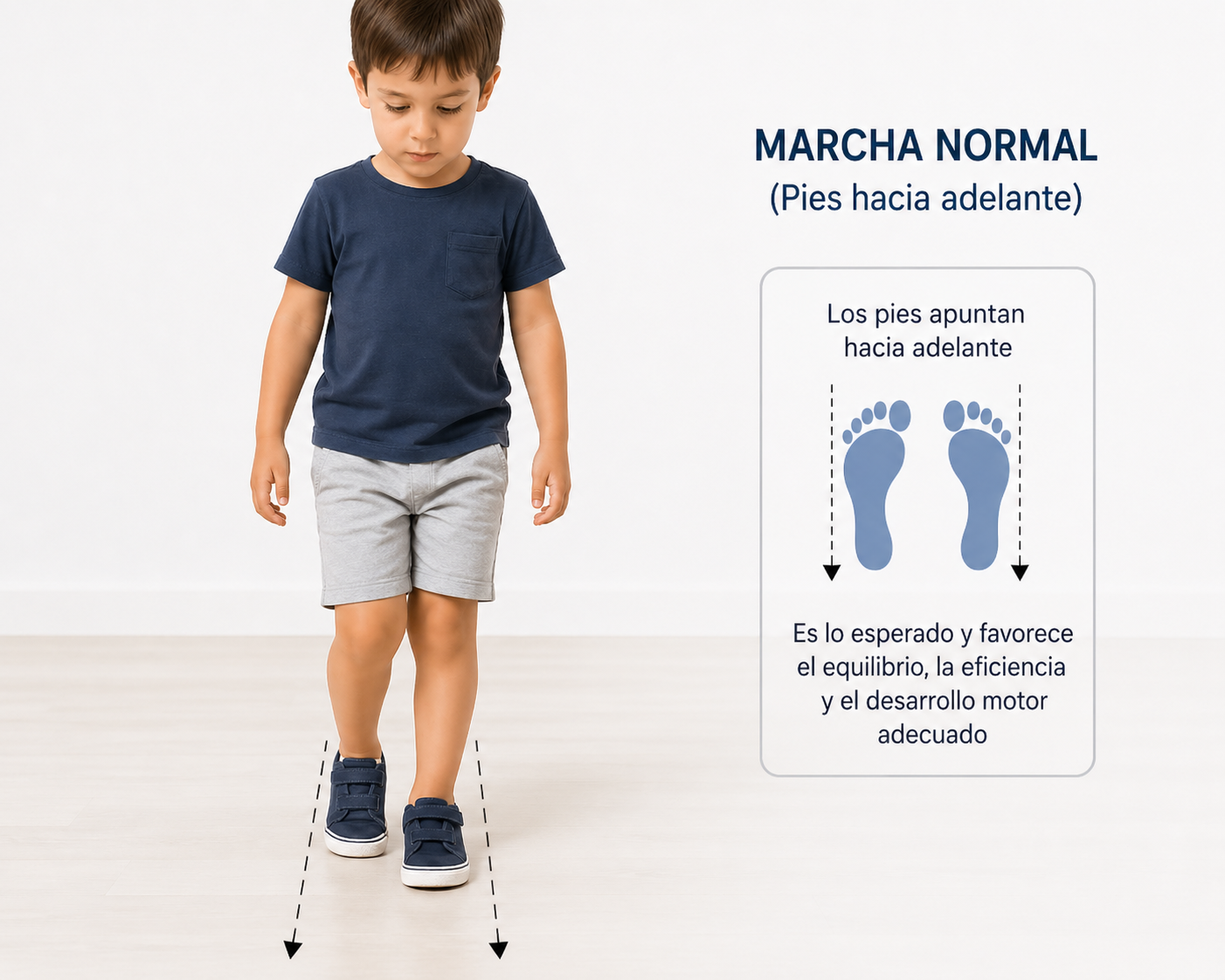 Comparación con una marcha normal en niños.