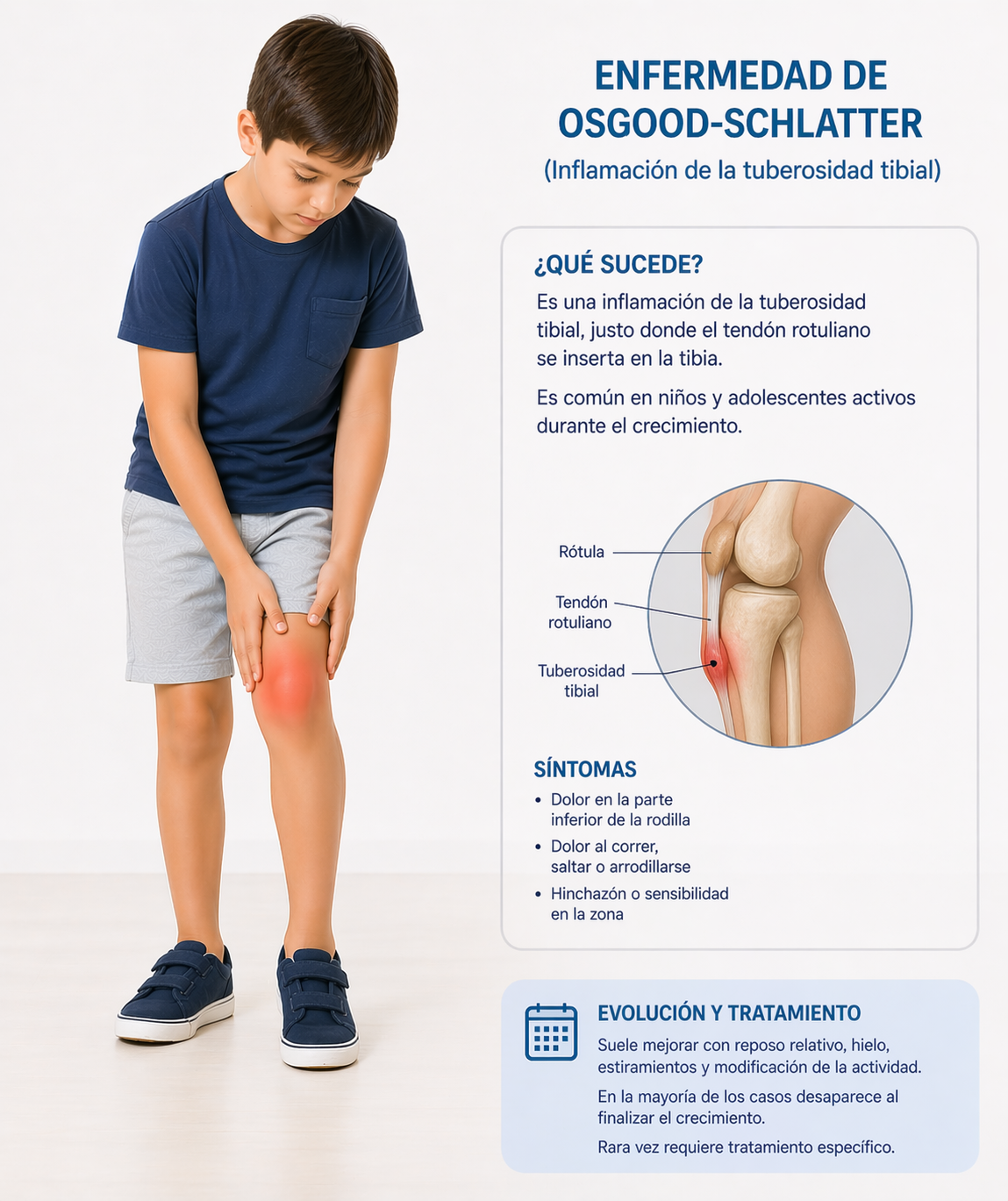 Ilustración adicional de dolor bajo la rodilla tipo Osgood-Schlatter.